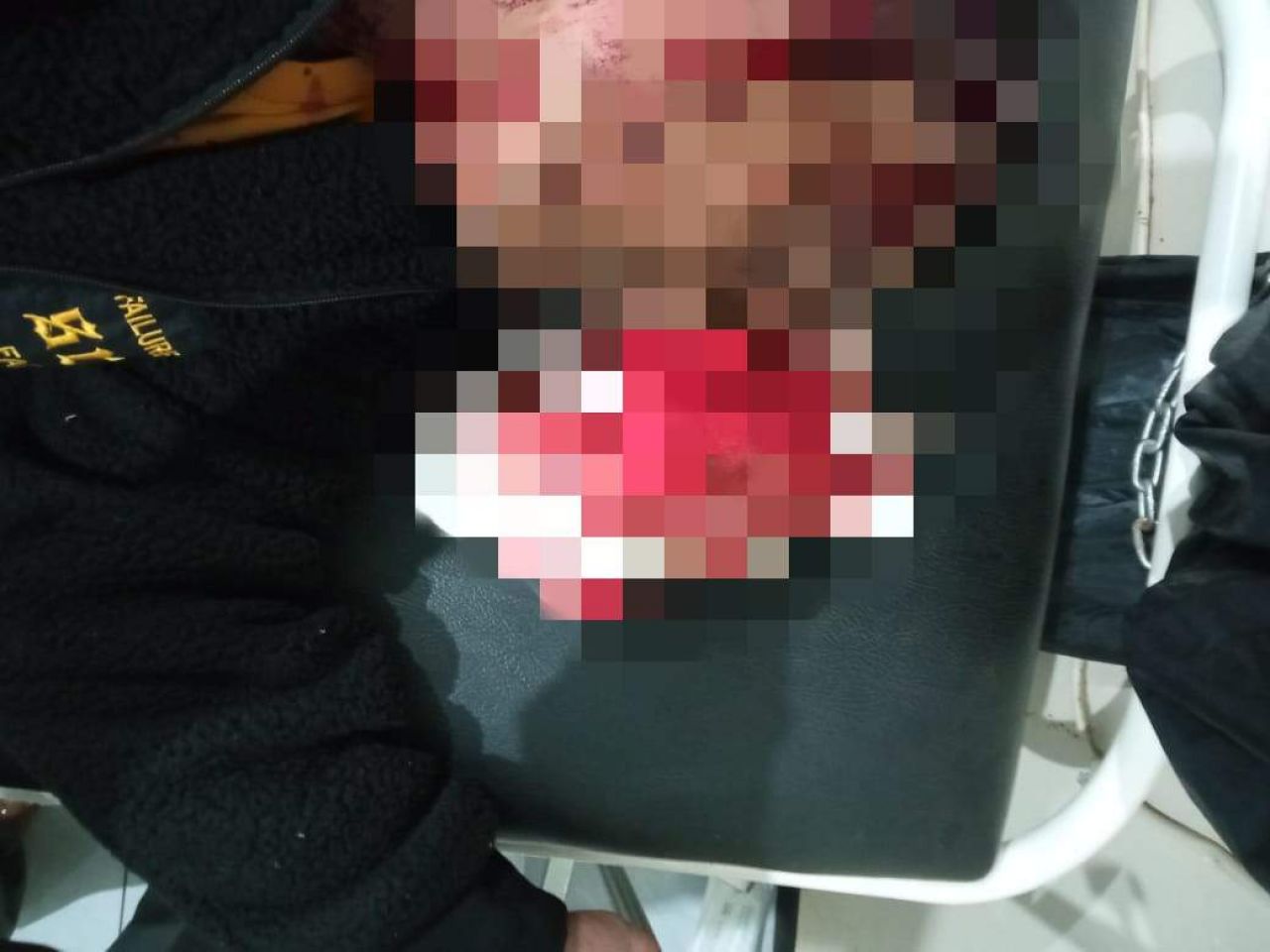 Diduga Usai Konfirmasi Proyek, Wartawan di Kabupaten Majalengka Menjadi Korban Pembacokan Orang Tak Dikenal