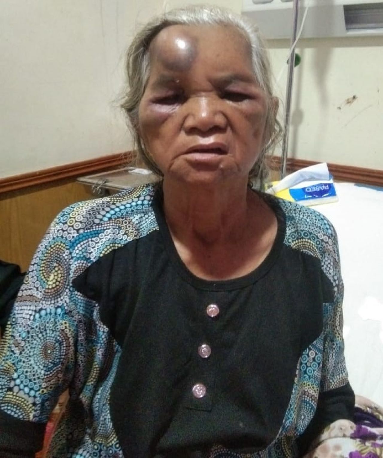 Mobil Box Indomaret Nopol BK 9997 Tabrak Betor, Seorang Nenek Terjungkal Menderita Luka Parah