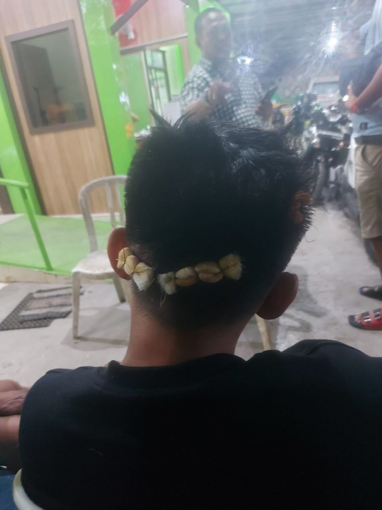 Dianiaya, Samsul Dilarikan ke Puskesmas Pandian